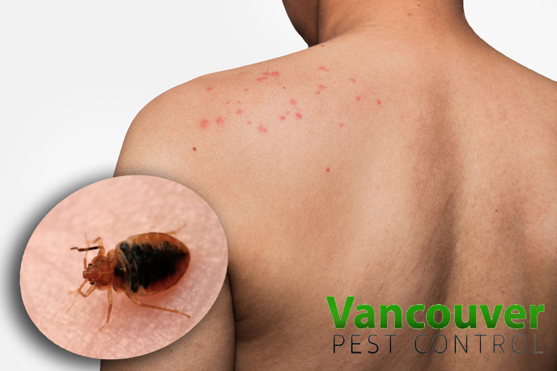bed bug control vancouver